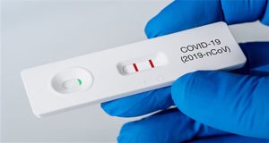 SARS-CoV-2 Schnelltest (Corona-Test)