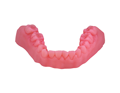 Teaser CAD-CAM