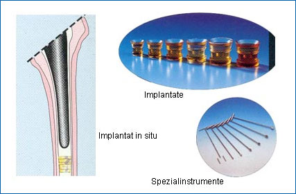 Biostop – resorbierbarer Markraumsperrer
