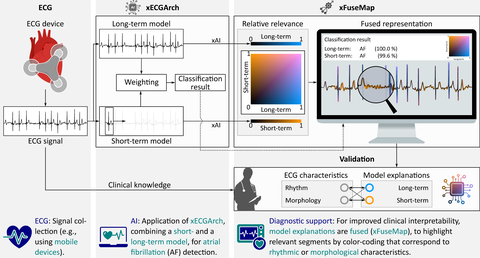 ecgXfusion® – Konzept