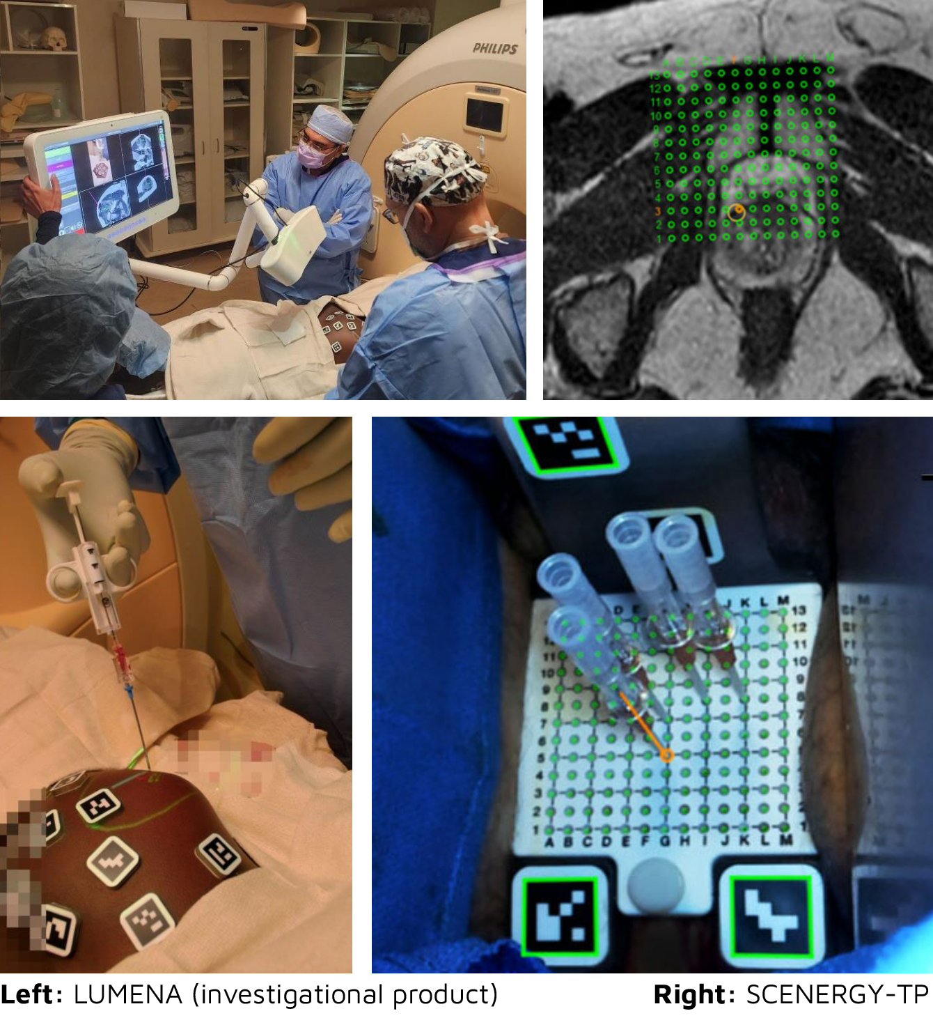 Clear Guide Medical Imaging Solutions