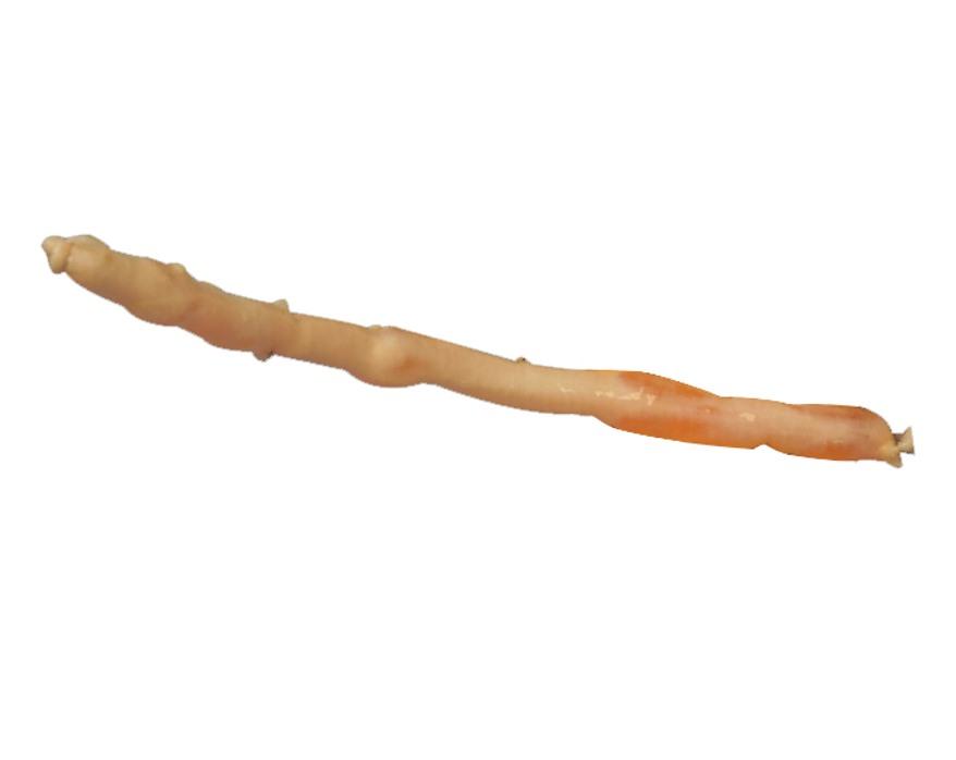 RestoreFlow Femoral Artery Allograft