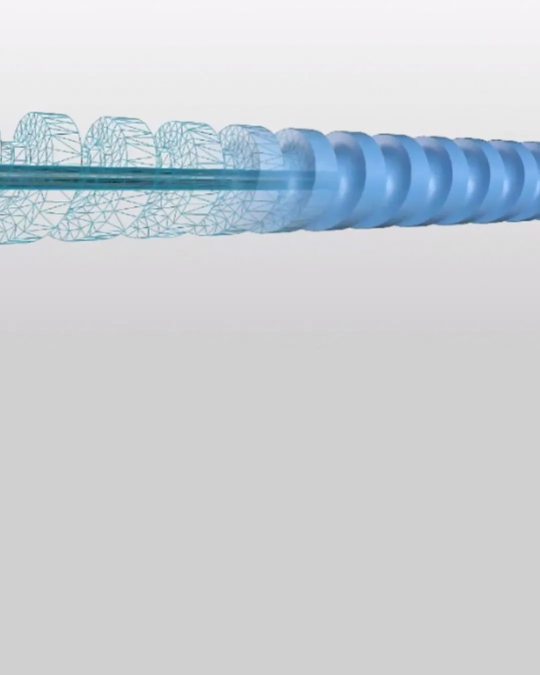 Hybrid plastic screw with CFRP tube
