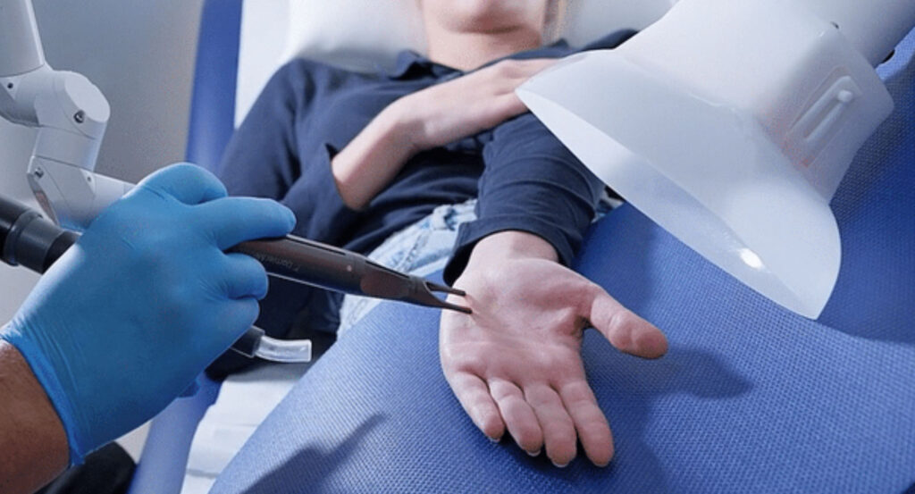 Absauganlagen für Laserrauch