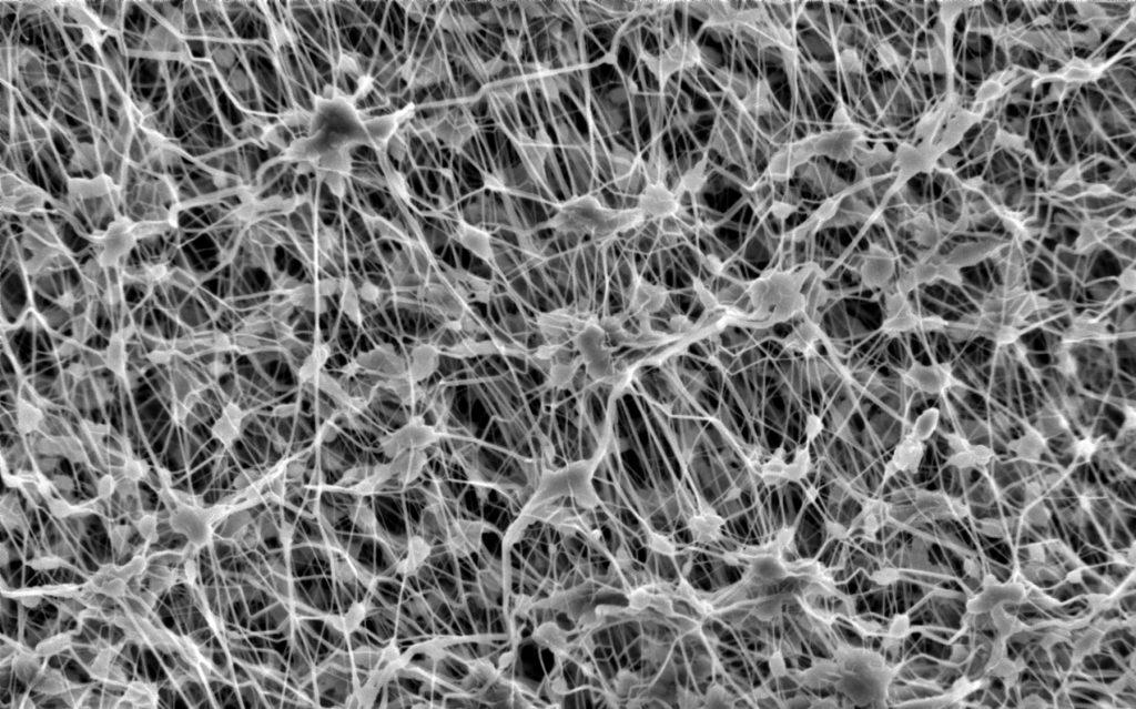 Membrantechnik