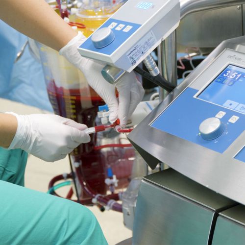Perfusionskonzepte (EKZ)