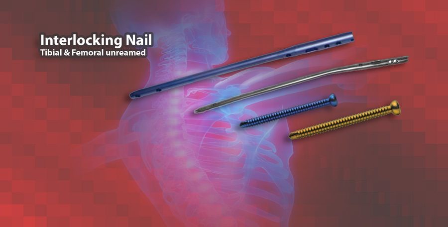 Tibia- und Femur-Interlocking-Nägel