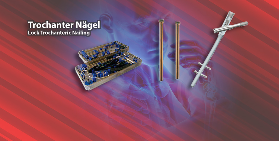 Lock Trochanteric Nailing