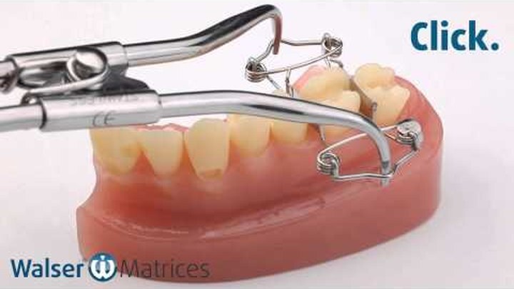 Walser dental matrix O-shape in Anwendung