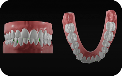 Behandlungsplanung mit 3D-Simulation