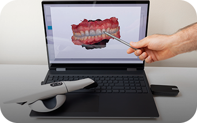 Intraoraler Scanner