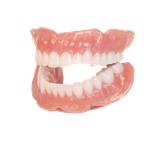 NextDent Vollprothese