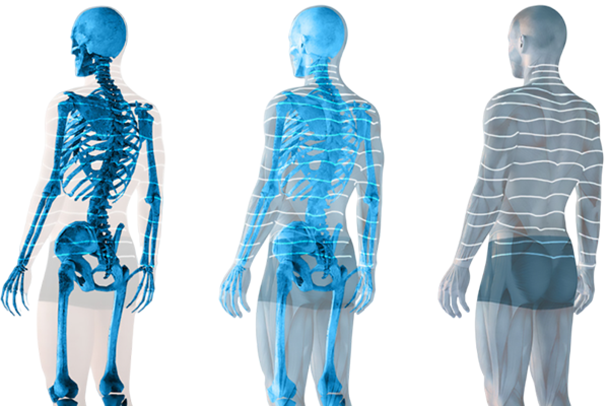 Messung mit 4D-Spine-Technologie