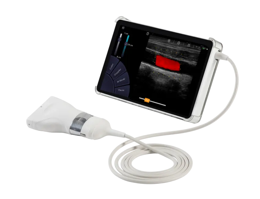 Sonoscanner U-Lite Pro Handultraschall