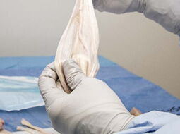 Transplantatprodukte für die Sportmedizin