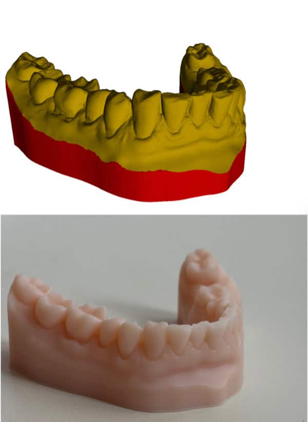 Dentalmodell / Bohrschablone
