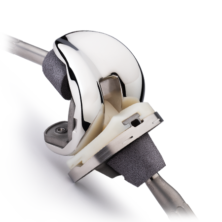Persona® Revision Knee