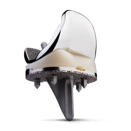 Persona® OsseoTi® Keel Tibia