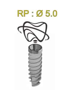 Implantat Active Hex RP 5mm
