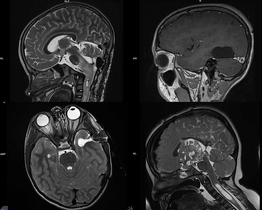 InVision 3T Operating Suite mit Siemens 3T Vida MRI