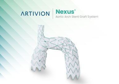NEXUS Aortic Arch Stent-Graft-System