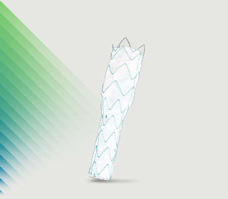 Thorakale Aorten-Stent-Grafts