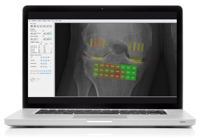 ImageBiopsy Lab Software