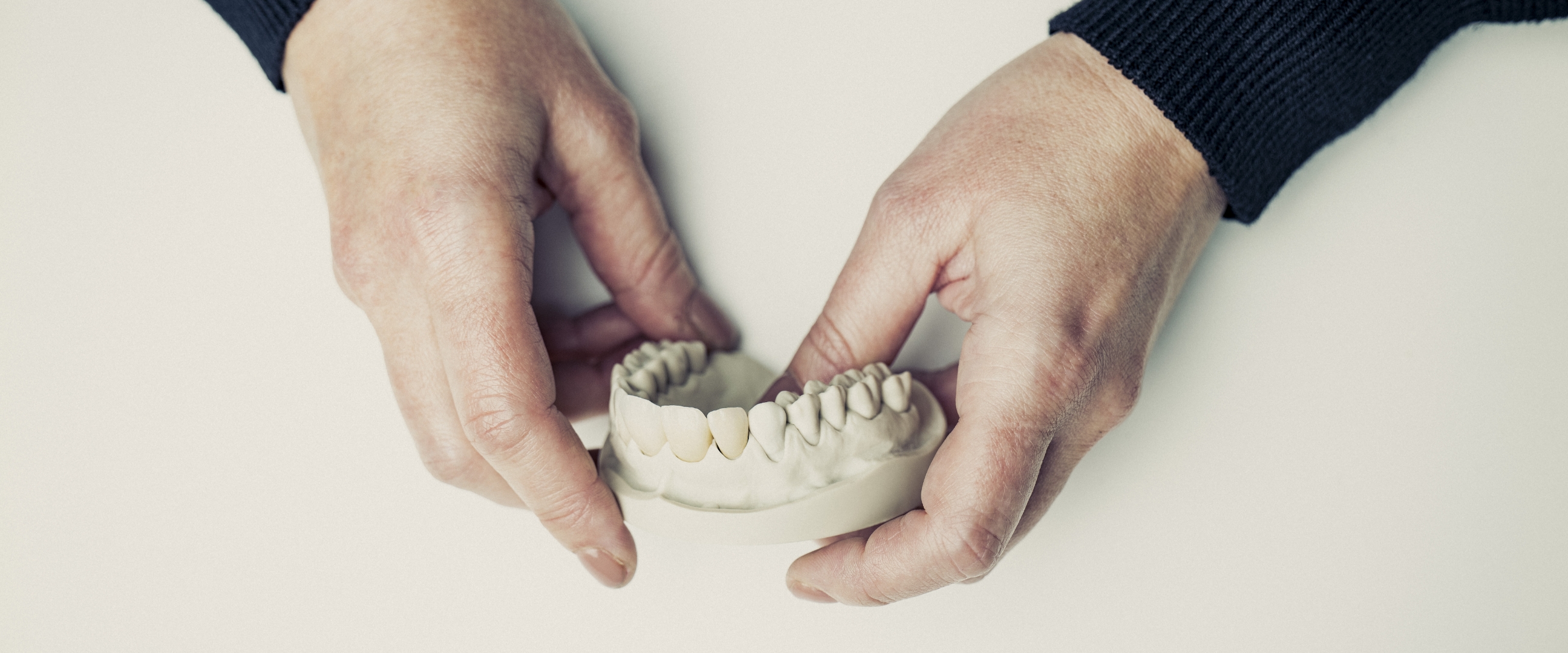 All-ceramic crowns, bridges and veneers