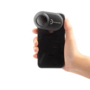 Digitale Dermatoskopie