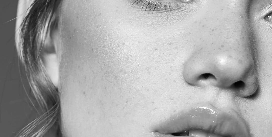 Lippen aufspritzen (Russian Lips)