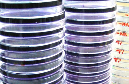 Ames-Test-Platten