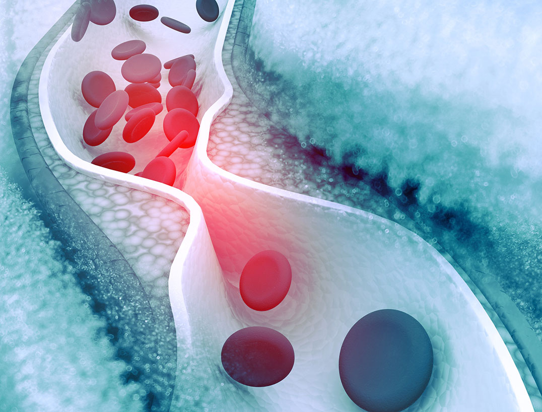 No blood clots – optimized flushing behavior