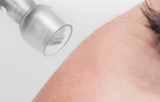 Microneedling-Geräte