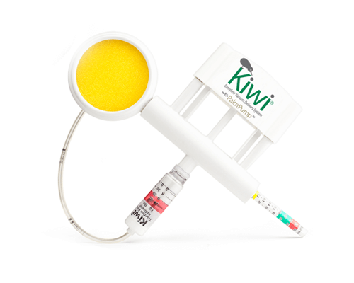Kiwi® Vakuum-Entbindungssystem