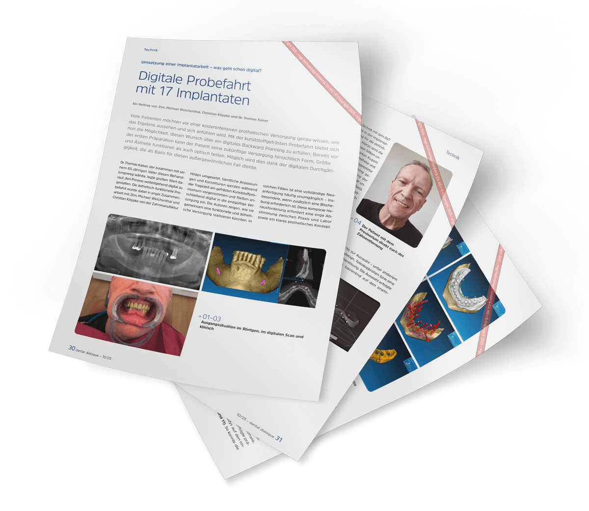 Fachbeitrag Digitale Implantatarbeit, Dental Dialogue